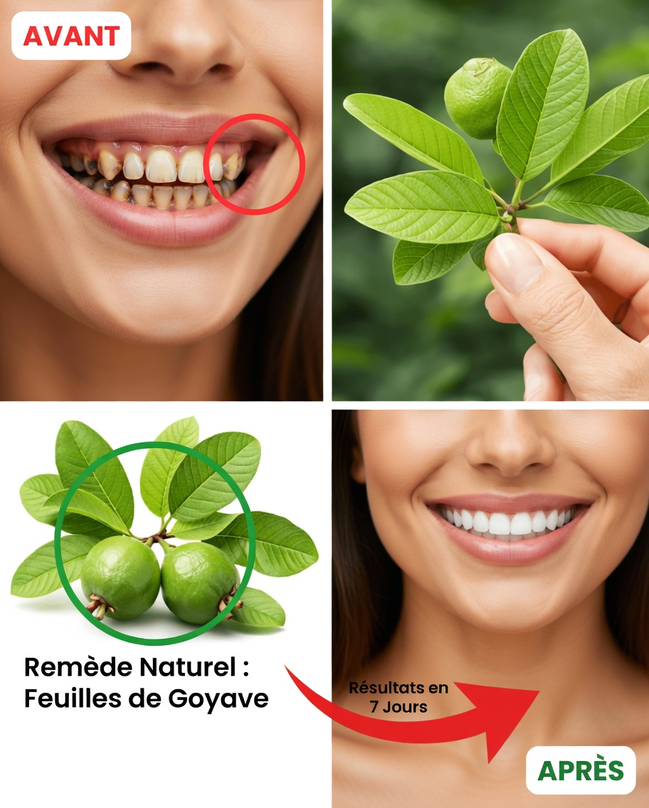 Dévoilez le secret de la nature pour votre sourire : Top 3 des remèdes à base de feuilles de goyavier pour soutenir les soins bucco-dentaires quotidiens