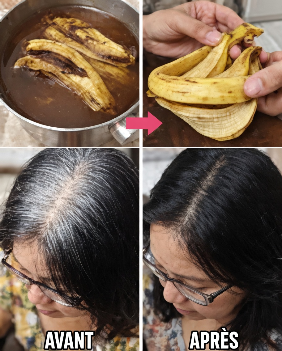 Cheveux blancs en cheveux noirs naturellement en seulement 3 minutes et faites pousser vos cheveux rapidement avec la peau de banane