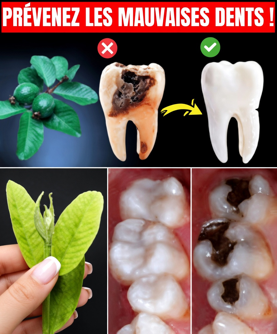 Top 3 façons naturelles de favoriser la santé des dents avec des feuilles de goyavier – simples et économiques !