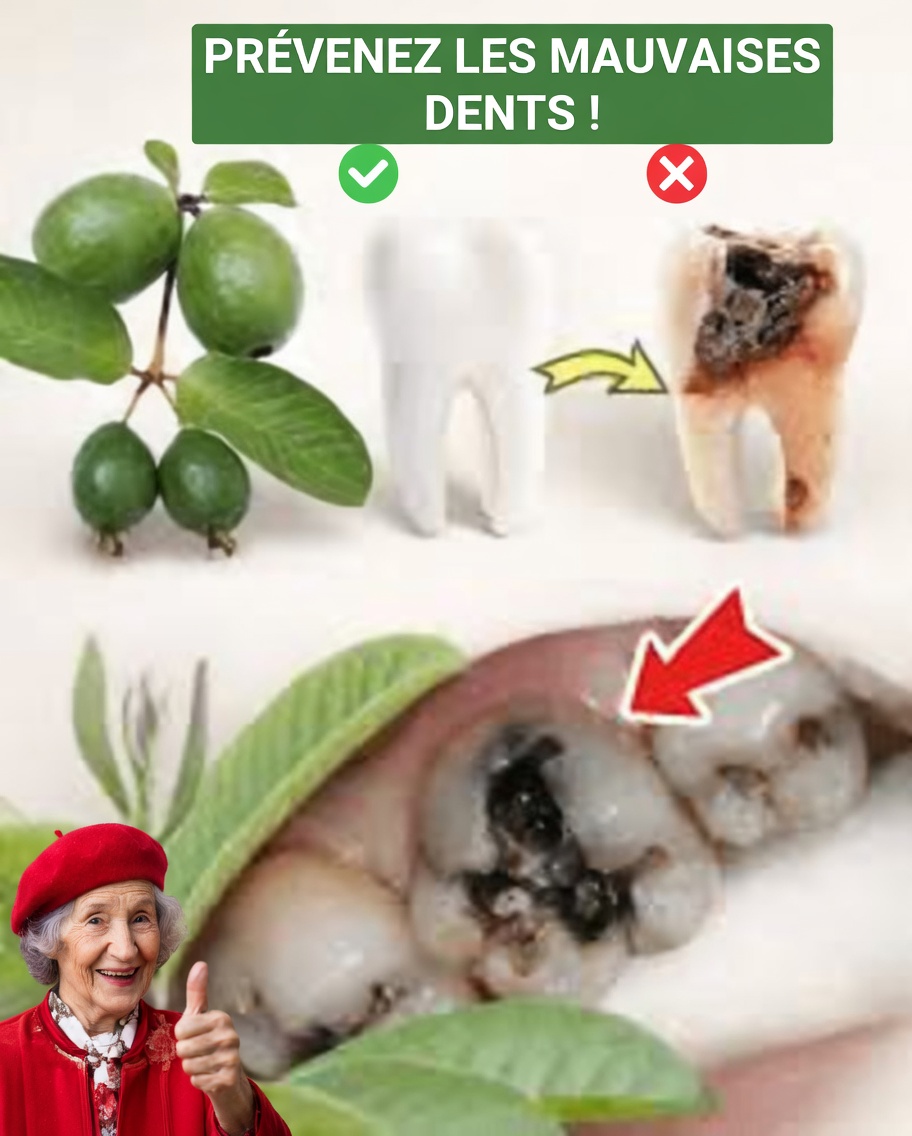 Top 3 façons naturelles de favoriser la santé des dents avec des feuilles de goyavier – simples et économiques !