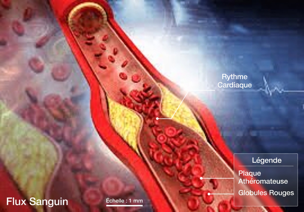 N’ignorez pas ces 10 signes avant-coureurs indiquant que vos artères pourraient être obstruées – la détection précoce est essentielle