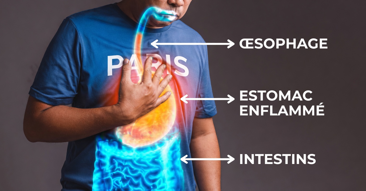 Dites adieu aux brûlures d’estomac et aux ballonnements : découvrez comment éliminer les bactéries qui les provoquent !