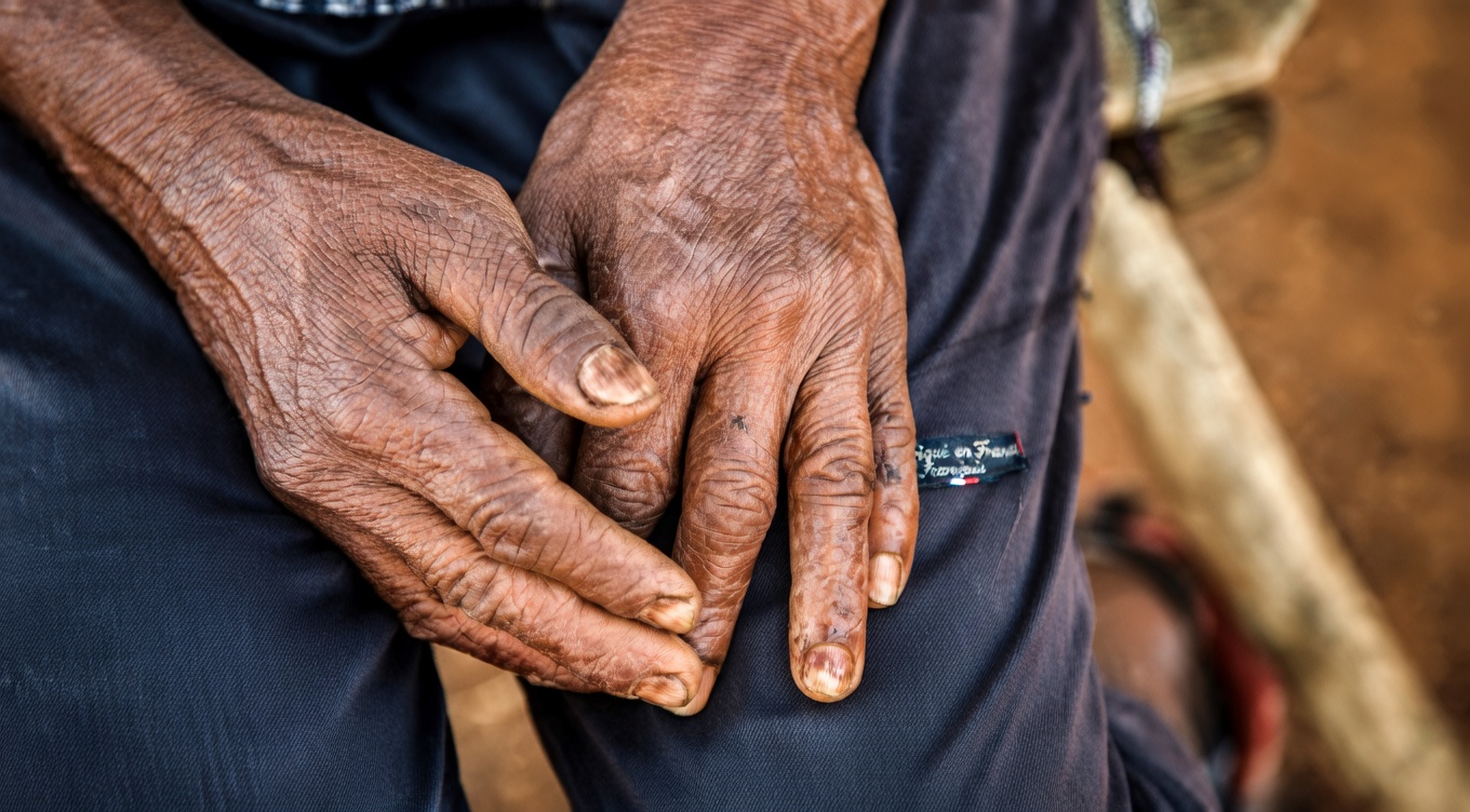 « On dirait que j’ai eu recours à une procédure esthétique » : le remède à domicile qui transforme les mains et les bras