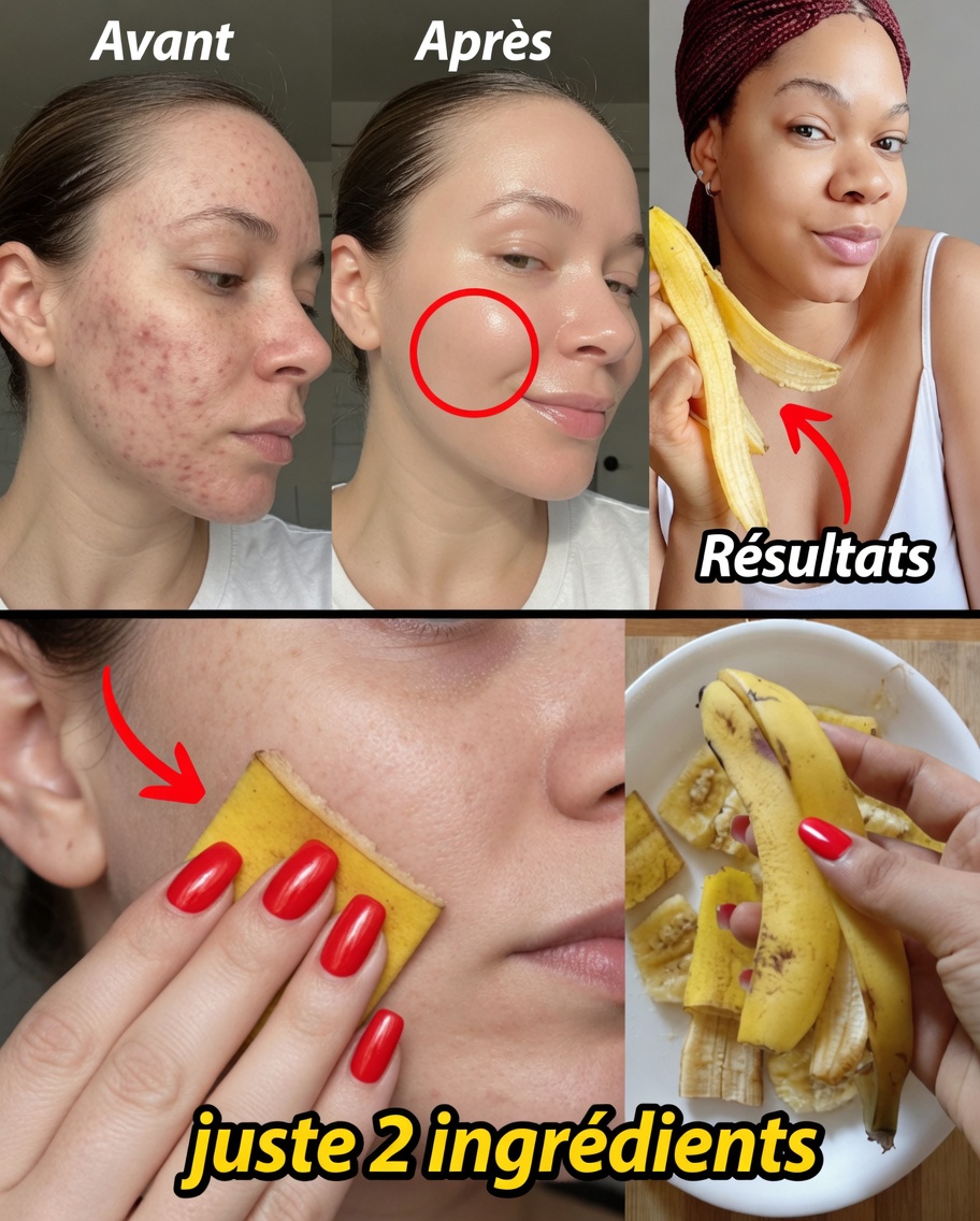 7 façons naturelles d’atténuer les ridules et de booster l’éclat de la peau grâce aux peaux de banane