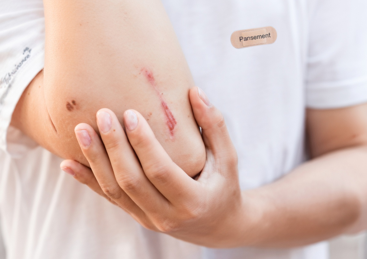 8 signes étranges que votre vitamine D est dangereusement basse – la plupart des gens les ignorent jusqu’à ce qu’il soit trop tard