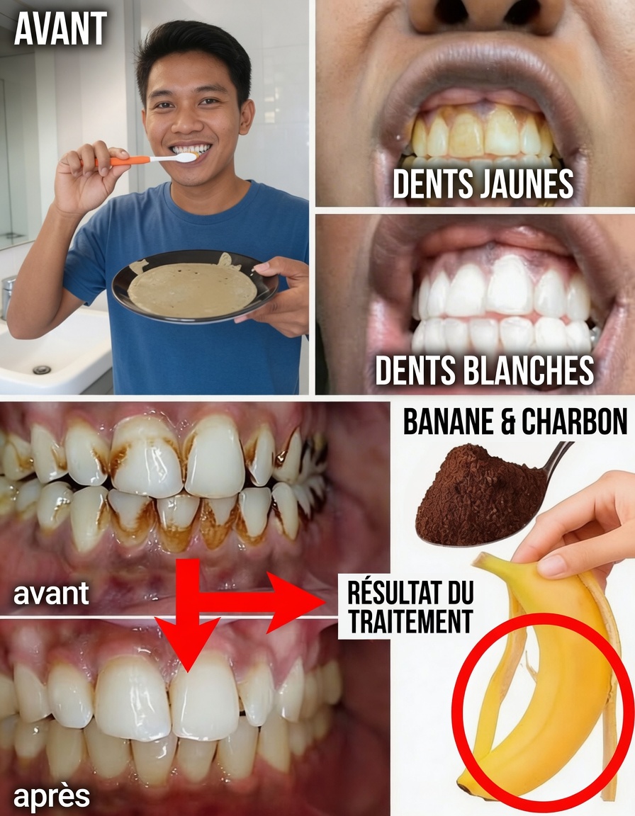 Comment éclaircir naturellement des dents jaunes à la maison : exploration de la méthode à la peau de banane, au gingembre et au citron