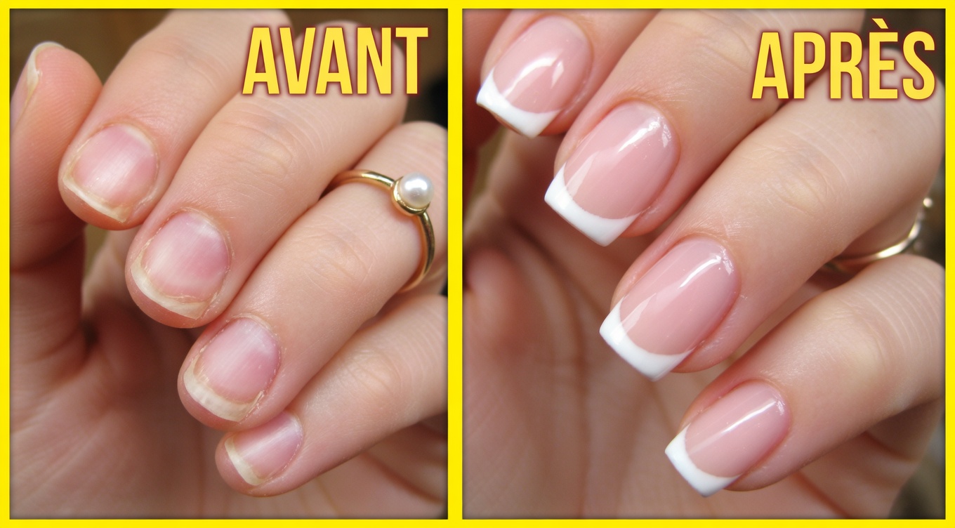 Comment faire pousser vos ongles visiblement plus longs et plus forts en seulement 10 jours, naturellement
