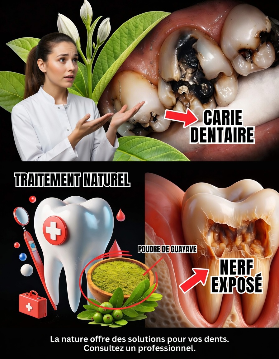 Top 3 façons simples d’utiliser des feuilles de goyavier pour favoriser des dents et des gencives plus saines à la maison