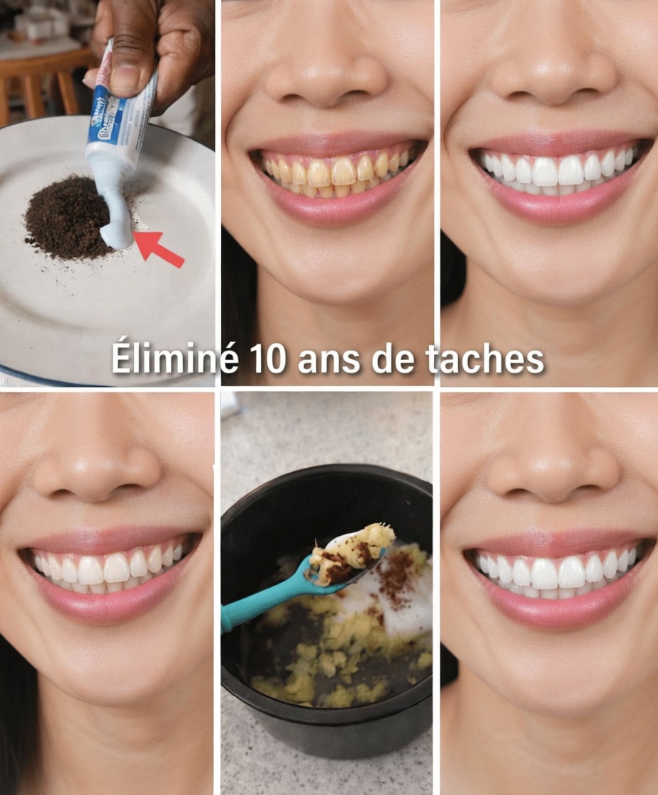 En seulement 2 minutes, éliminez 10 ans de taches sur les dents – Le blanchisseur naturel qui fonctionne vraiment