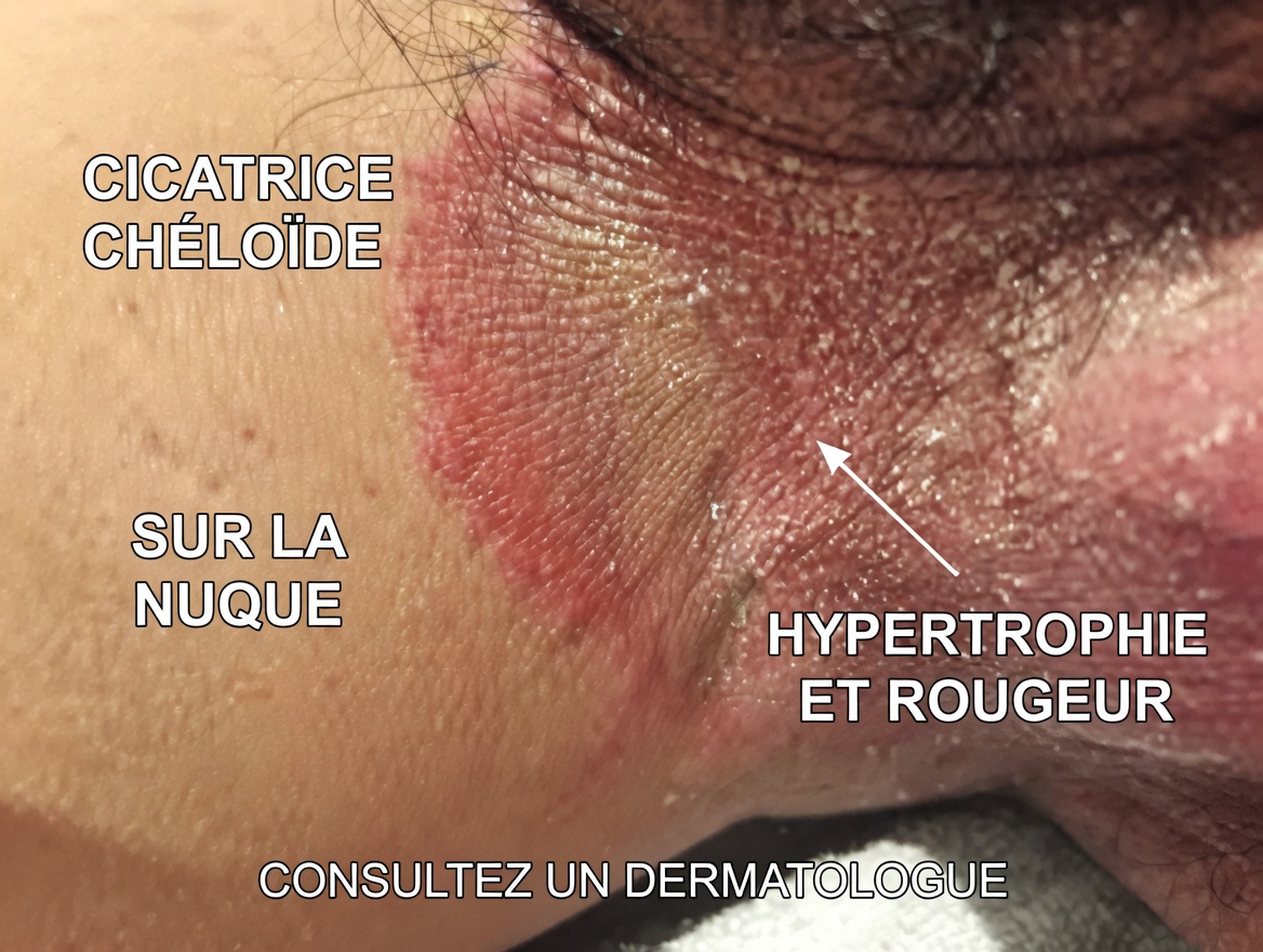 Voici les signes qu’il est cr…