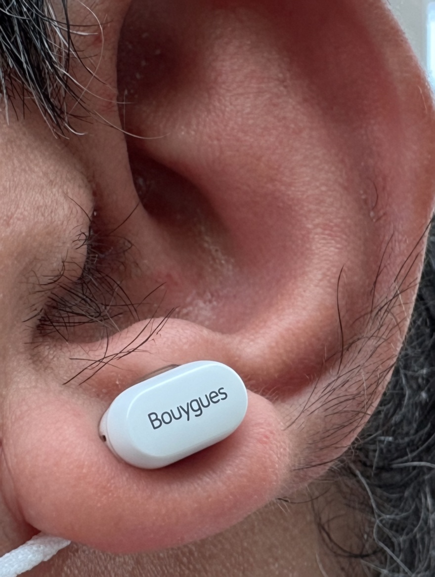 Poils d’oreille et votre santé : ce que les médecins disent de ce signe corporel négligé