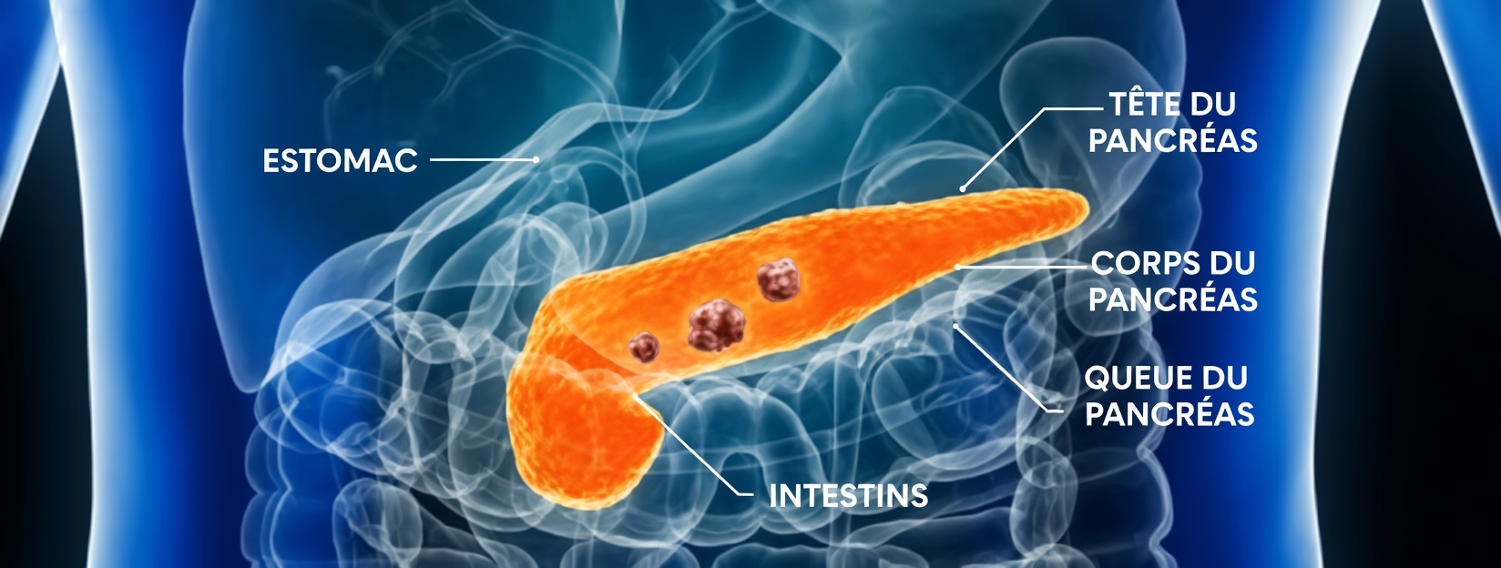 12 signes avant-coureurs précoces du cancer du pancréas à ne jamais ignorer et comment les reconnaître