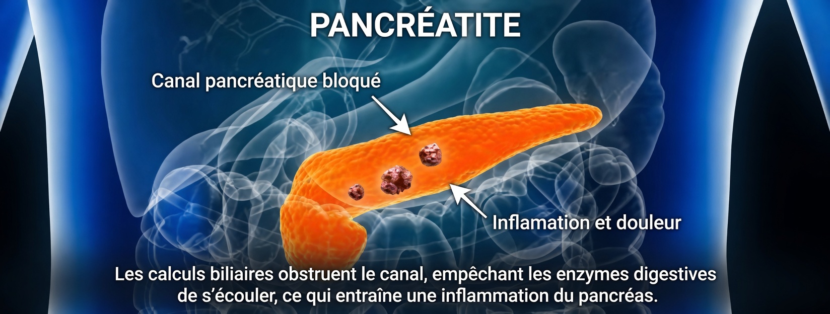 10 signes avant-coureurs alarmants du cancer du pancréas que vous ne pouvez pas ignorer