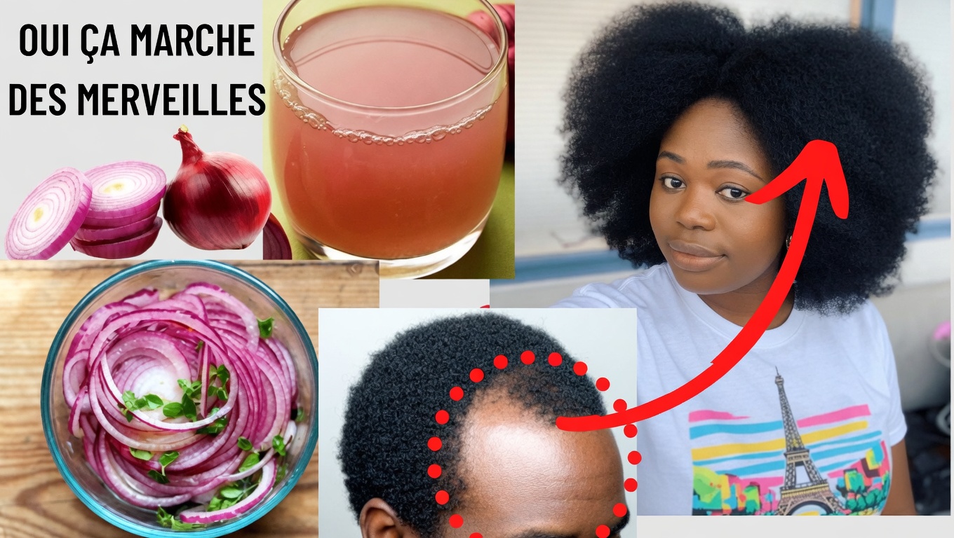 Le tonique indien pour cheveux « fusée » à 3 ingrédients qui fait pousser 2,5 à 5 cm par mois et comble les zones dégarnies en 14 jours