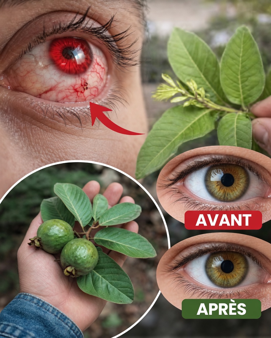 Comment utiliser la goyave pour traiter les problèmes oculaires — Remèdes naturels pour les yeux après 40 ans
