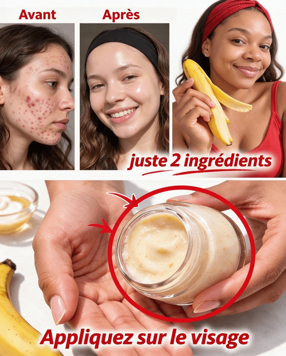 7 façons naturelles d’atténuer les ridules et de booster l’éclat de la peau avec des peaux de banane