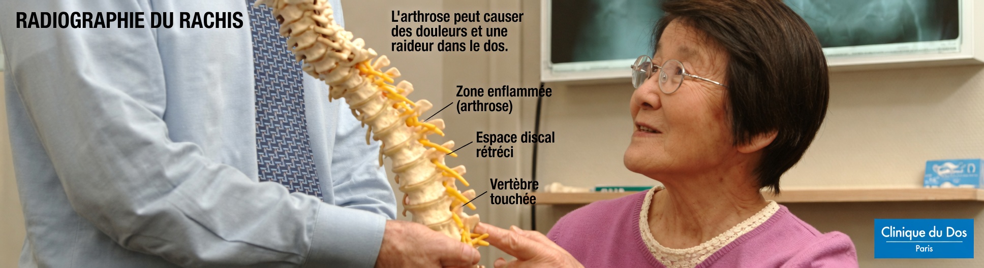 Le plus vieux médecin du Japon : inverser l’ostéoporose grâce à 6 conseils qui changent la vie — augmenter rapidement la densité osseuse