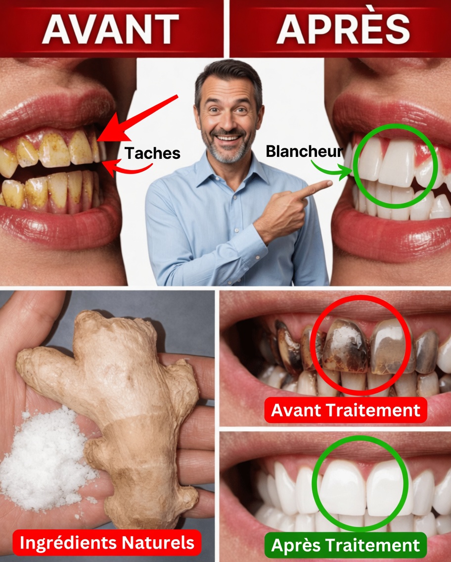 Dites adieu à la plaque dentaire pour toujours — les dentistes le cachent !