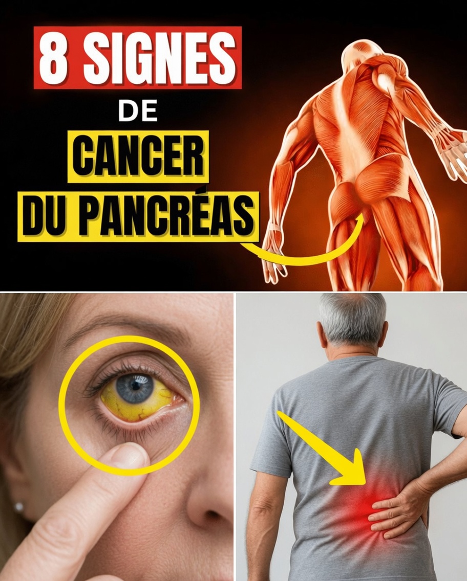 8 Symptômes choquants du cancer du pancréas que vous ne devez JAMAIS ignorer | Signes d’alerte précoces