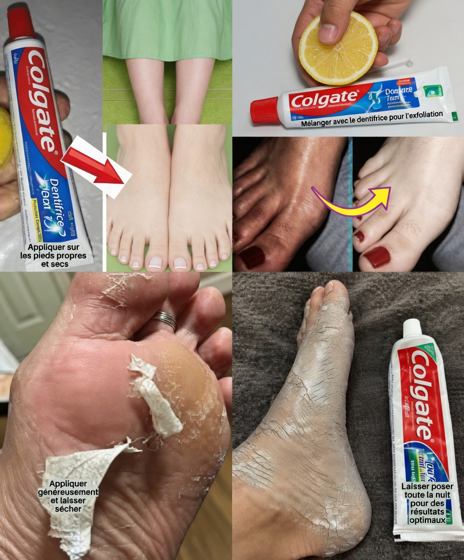 Découvrez le secret de Colgate pour des pieds doux et soyeux