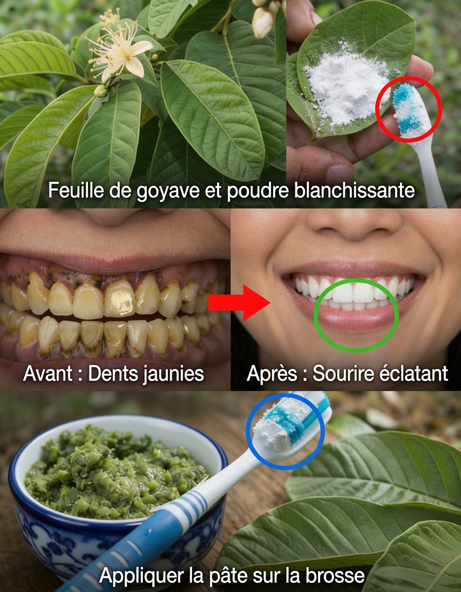 Top 3 des moyens simples par lesquels les feuilles de goyave peuvent aider à apaiser la carie dentaire et les symptômes du mal de dents