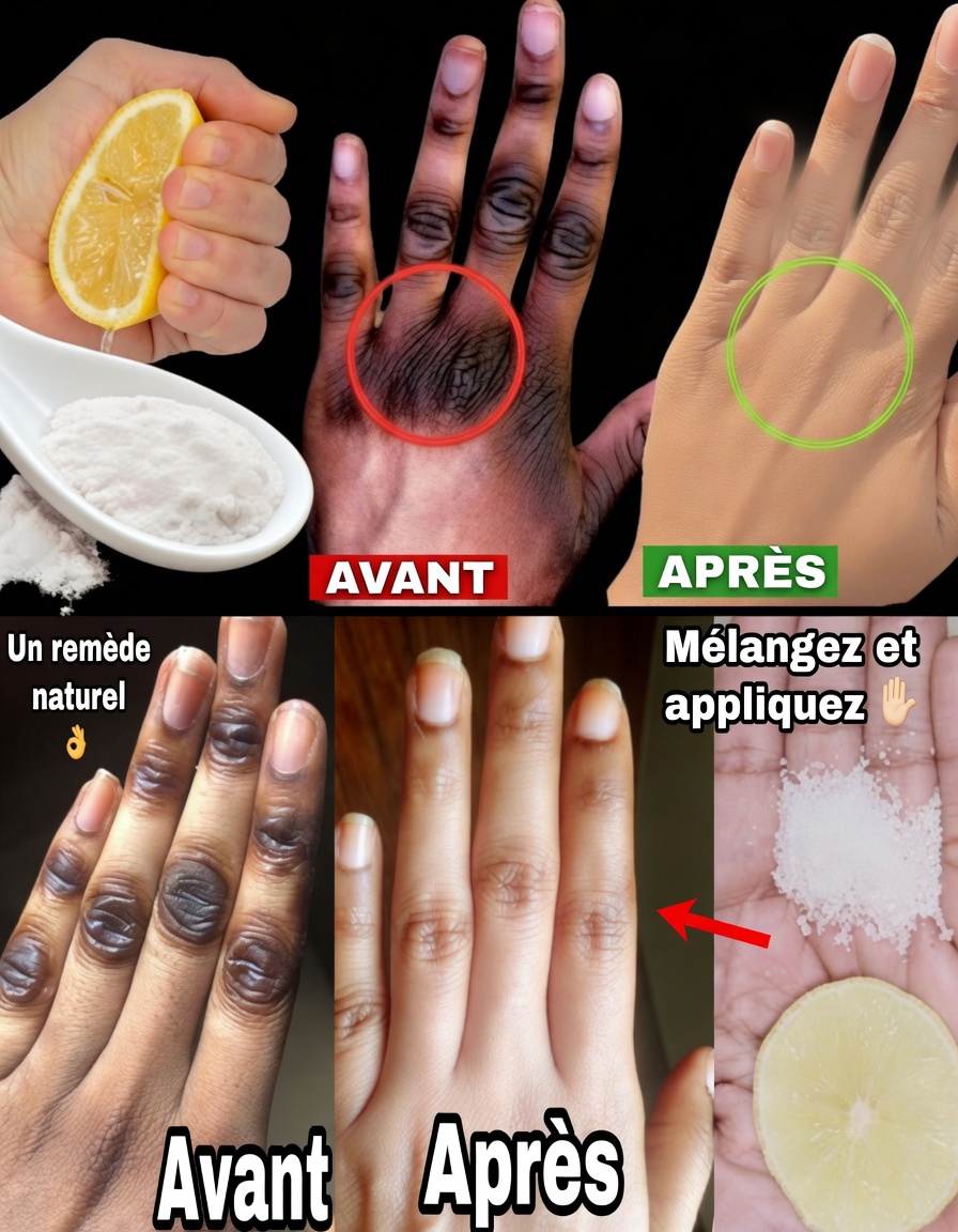 Comment je garde mes mains douces, sans rides, lisses et plus jeunes — le simple masque pour les mains au citron + sucre + café qui fonctionne vraiment