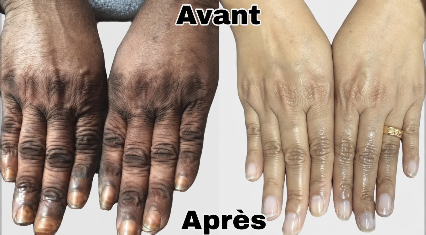 Comment je garde mes mains douces, sans rides, lisses et plus jeunes — le simple masque pour les mains au citron + sucre + café qui fonctionne vraiment