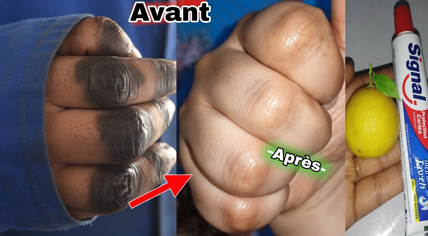 Comment je garde mes mains douces, sans rides, lisses et plus jeunes — le simple masque pour les mains au citron + sucre + café qui fonctionne vraiment