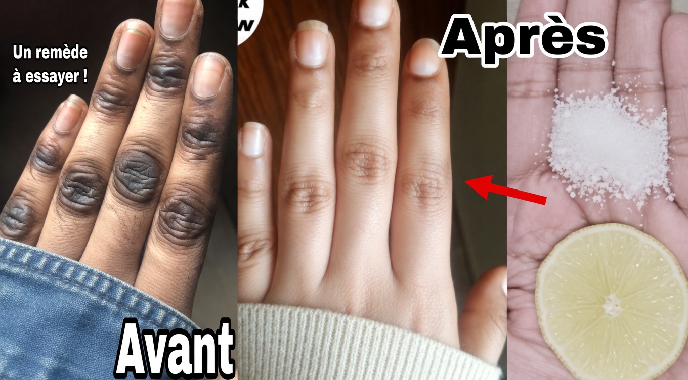 Comment je garde mes mains douces, sans rides, lisses et plus jeunes — le simple masque pour les mains au citron + sucre + café qui fonctionne vraiment