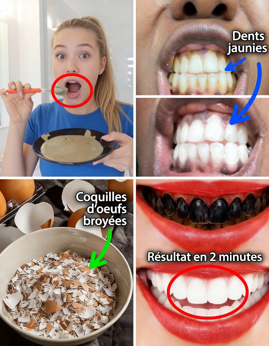 Blanchiment des dents à l’œuf et au café : le remède maison viral qui pourrait éclaircir les dents jaunes – ce qui fonctionne vraiment et ce à quoi il faut faire attention
