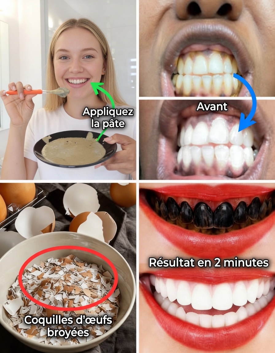En seulement 2 minutes, éliminez 10 ans de taches sur les dents – Le blanchissant naturel qui fonctionne vraiment