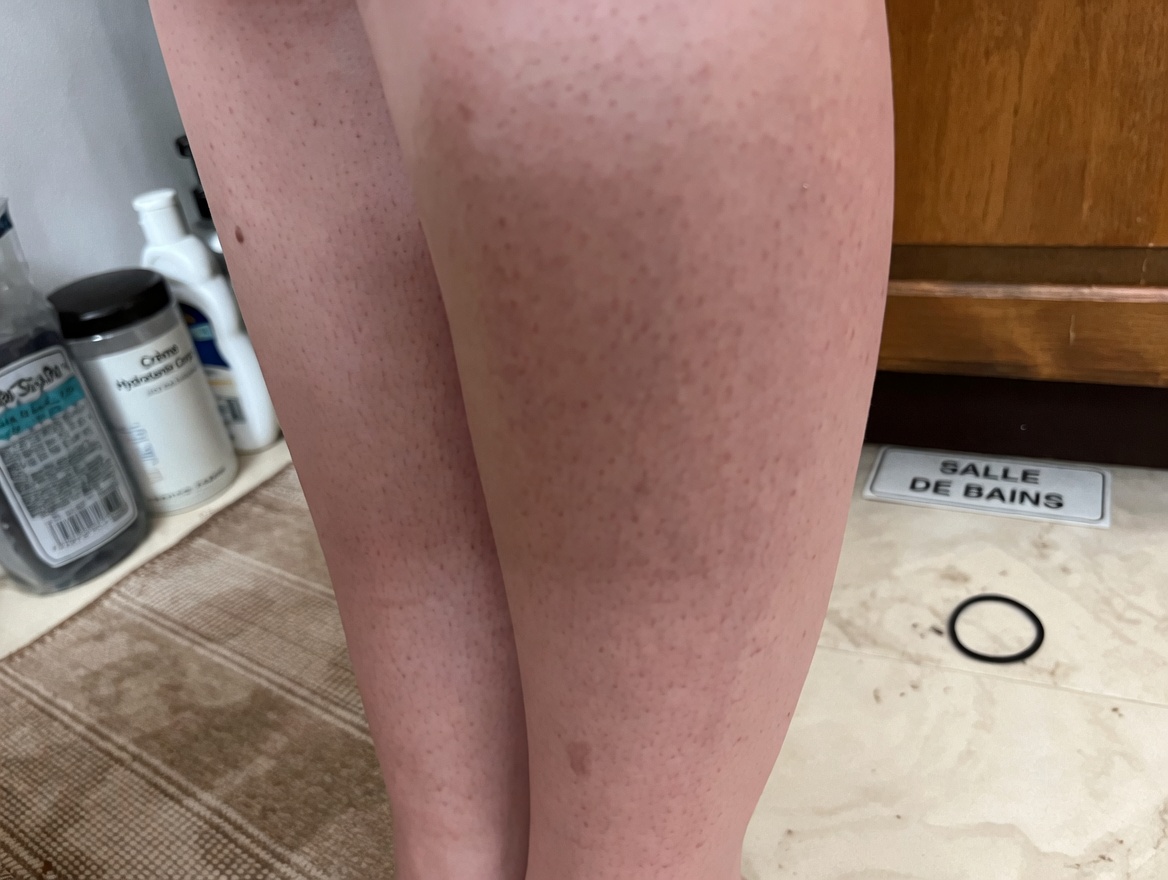 Arrêtez la galère du rasage : l’oignon et le dentifrice sont-ils le secret naturel d’épilation que vous attendiez ?