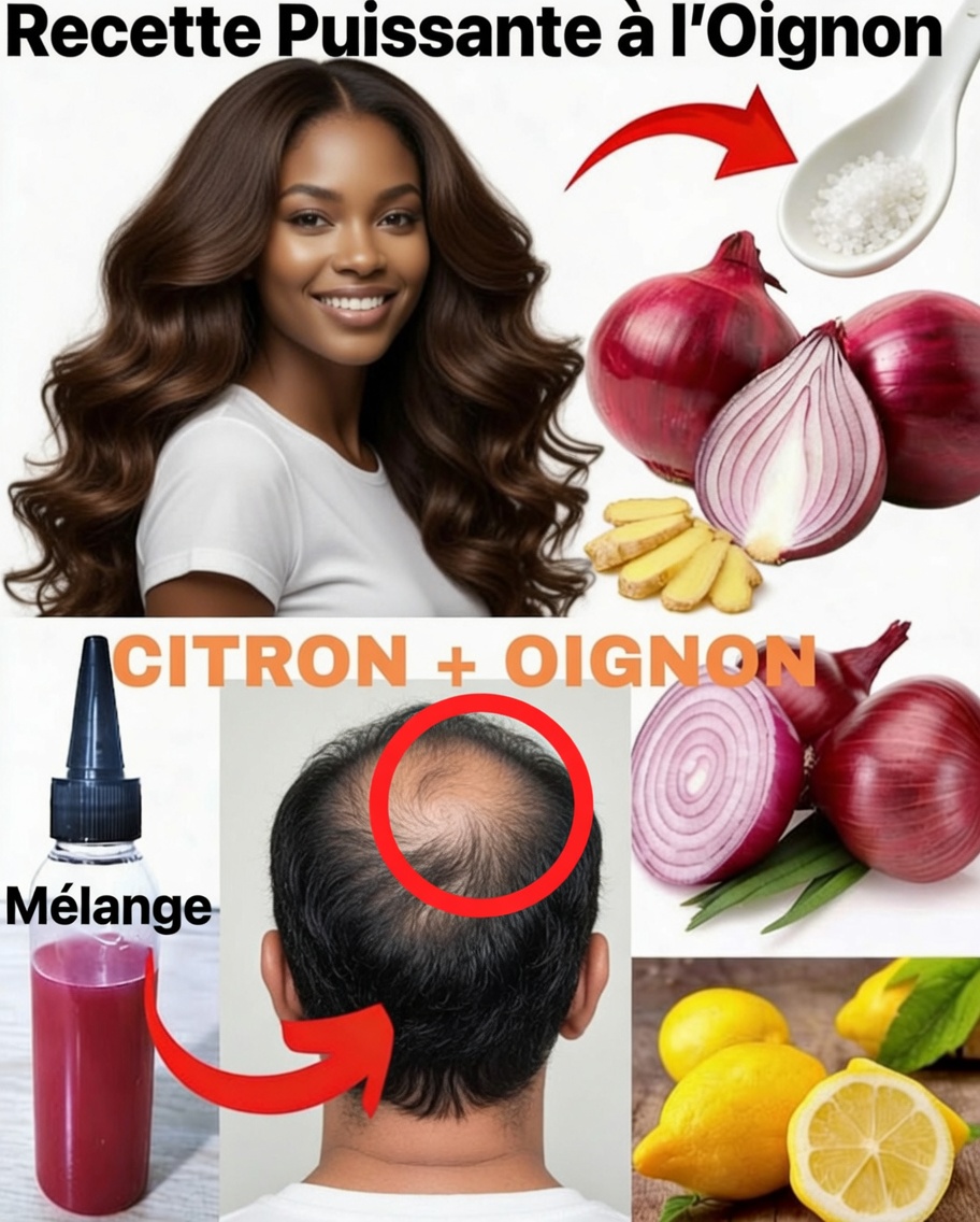 Comment améliorer naturellement la couleur des cheveux gris avec des pelures d’oignon : un guide doux à domicile pour des résultats subtils