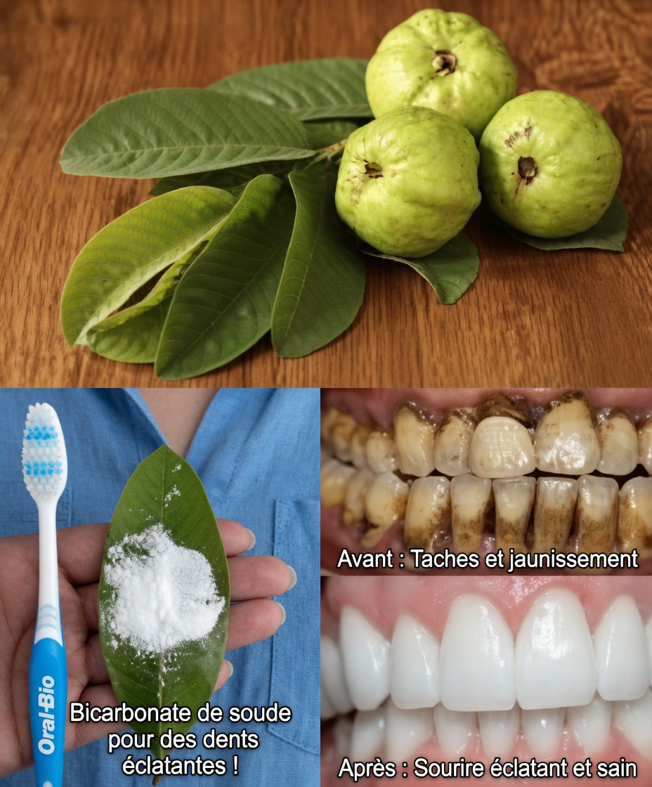 Top 3 façons de traiter la carie dentaire avec des feuilles de goyave – simples et économiques