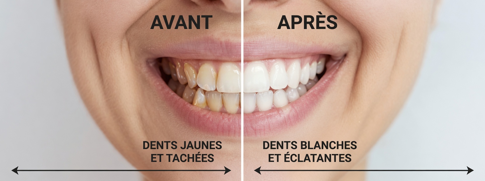 Top 3 façons de traiter la carie dentaire avec des feuilles de goyave – simples et économiques