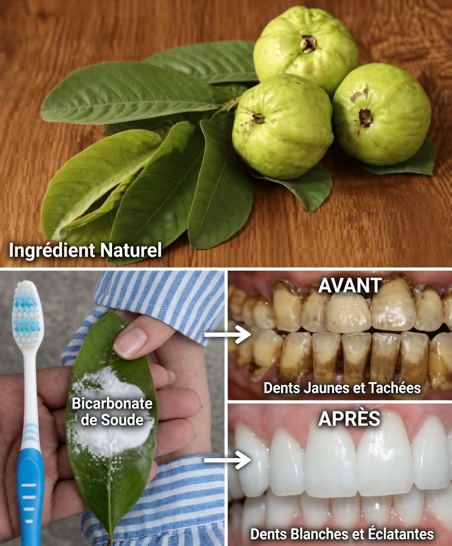 Comment éclaircir naturellement votre sourire avec des feuilles de goyavier : un remède maison doux