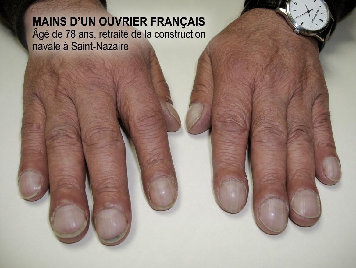 8 changements imperceptibles dans votre corps qui pourraient être le signe avant-coureur de problèmes de santé