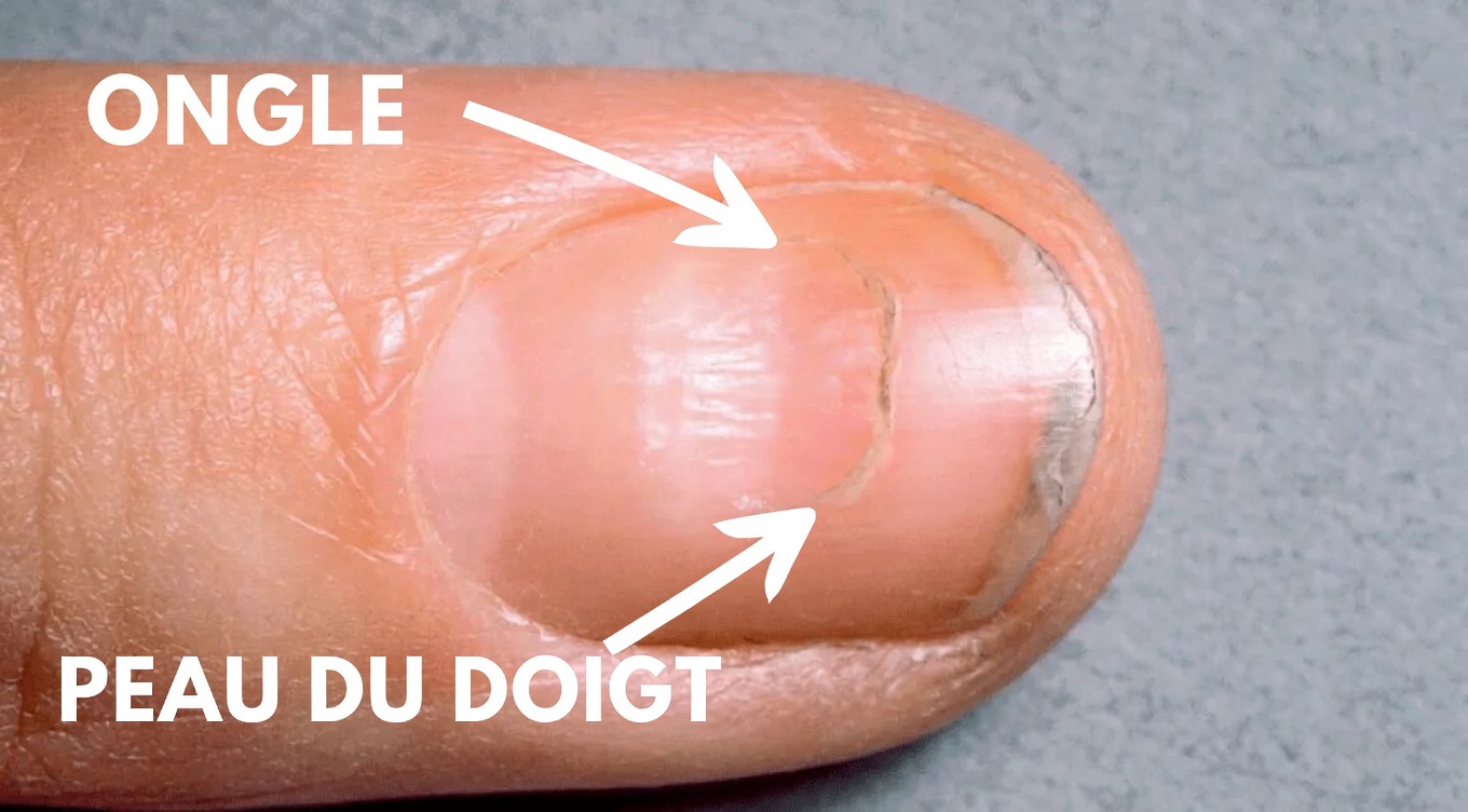 8 changements imperceptibles dans votre corps qui pourraient être le signe avant-coureur de problèmes de santé