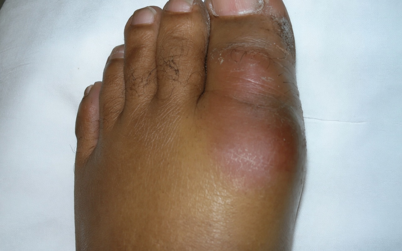 11 aliments validés par la recherche qui peuvent aider à réduire naturellement votre taux d’acide urique