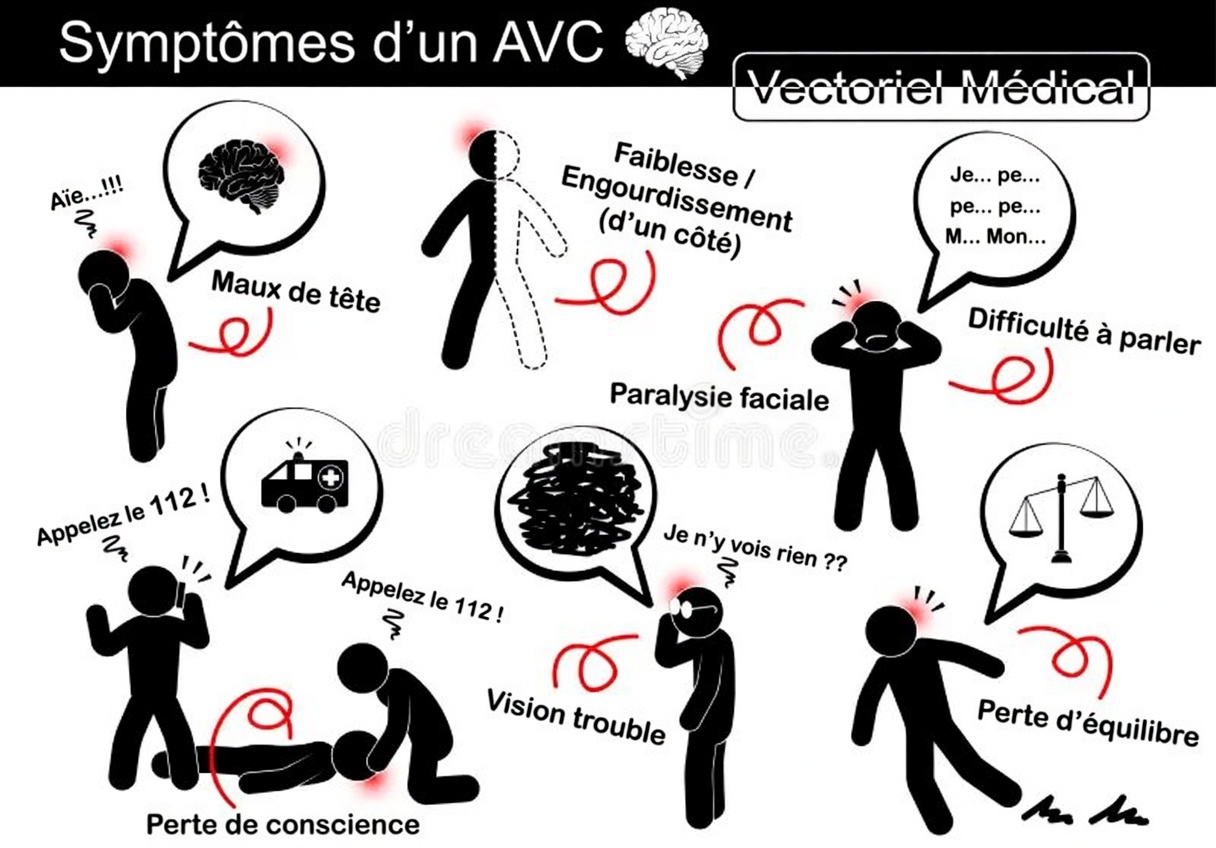 Un mois avant un AVC, votre corps vous avertit : 10 signes à ne pas ignorer