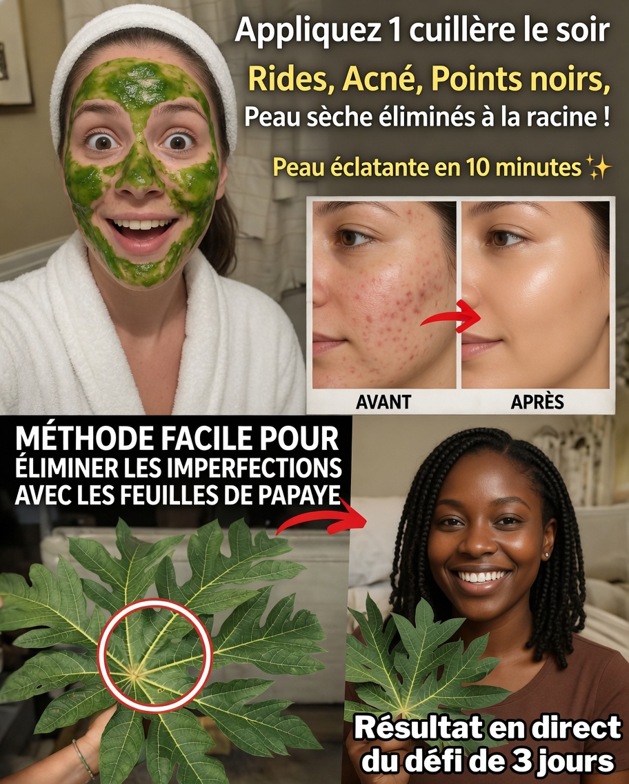 Le remède surprenant à base de feuilles de papayer qui aide des milliers de personnes à atténuer naturellement le mélasma, la pigmentation et les taches brunes