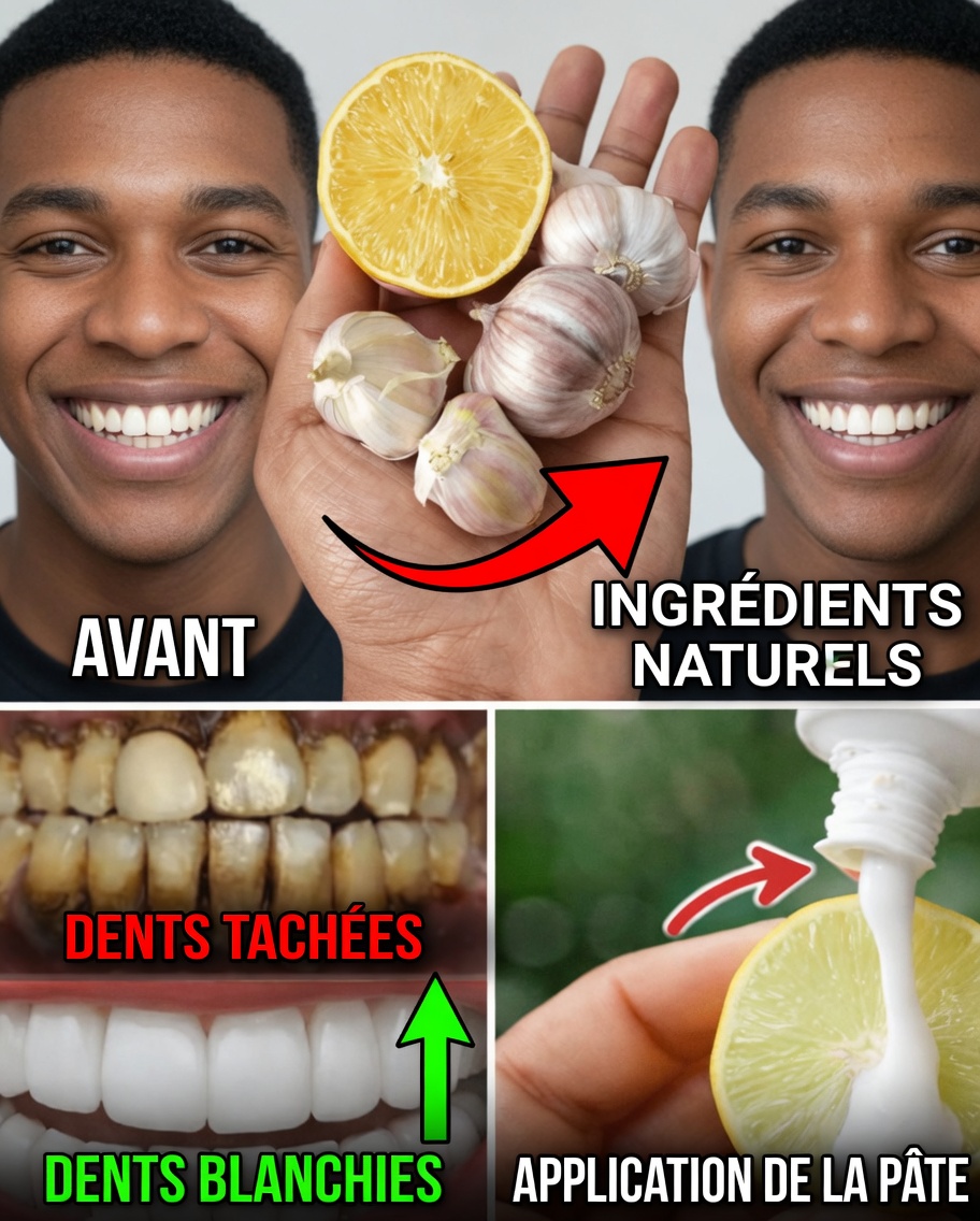 Comment blanchir naturellement des dents jaunes à la maison : le puissant secret banane-gingembre-citron dont des milliers raffolent