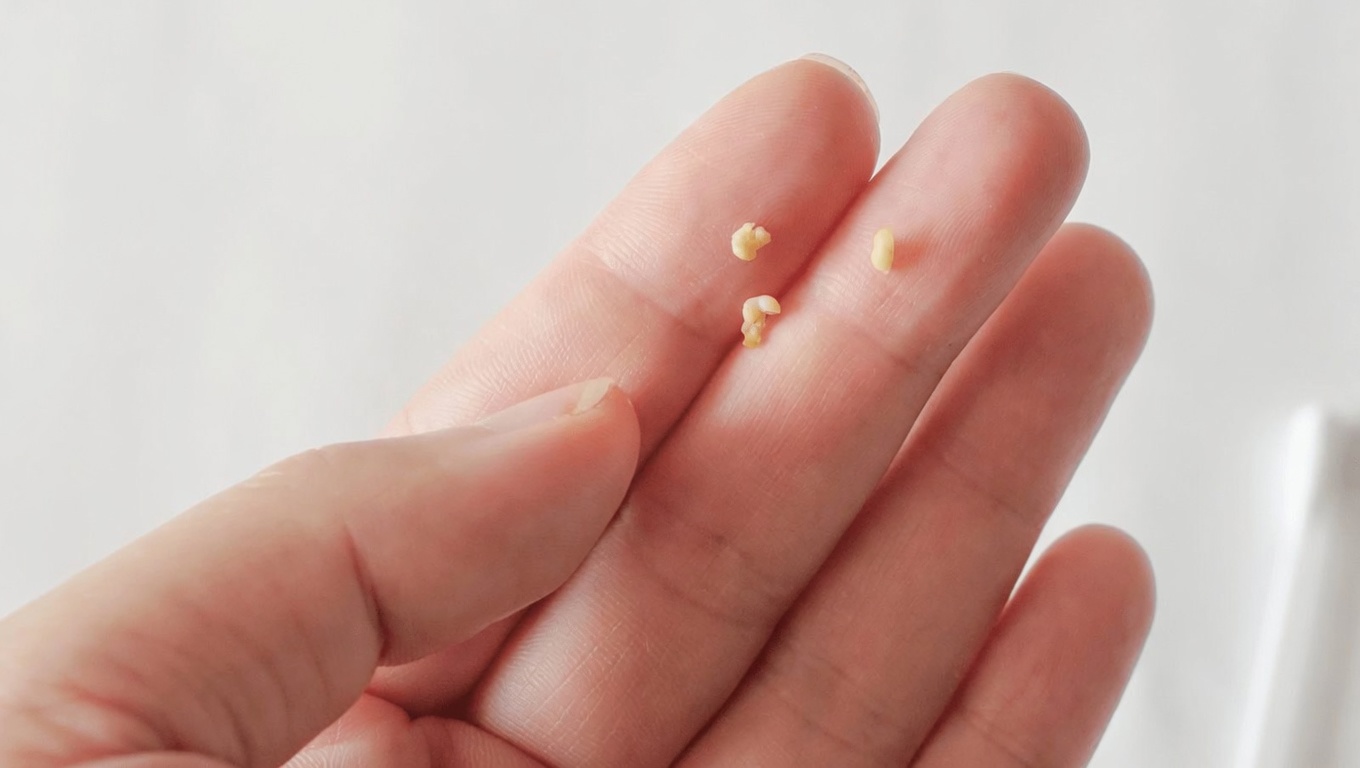 Comprendre les calculs amygdaliens : ce que vous devez savoir et comment les gérer