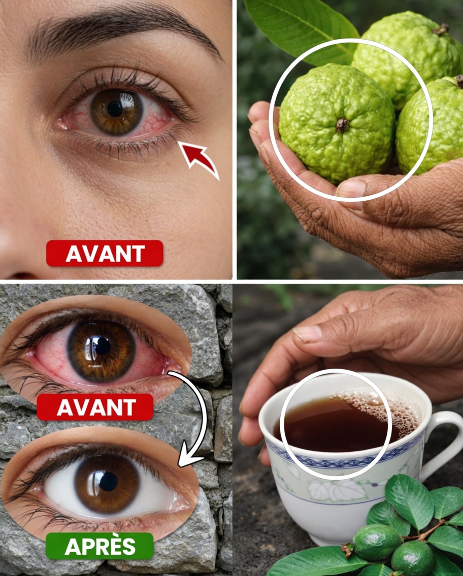 Comment utiliser la goyave pour soutenir la santé des yeux — Remèdes naturels à connaître