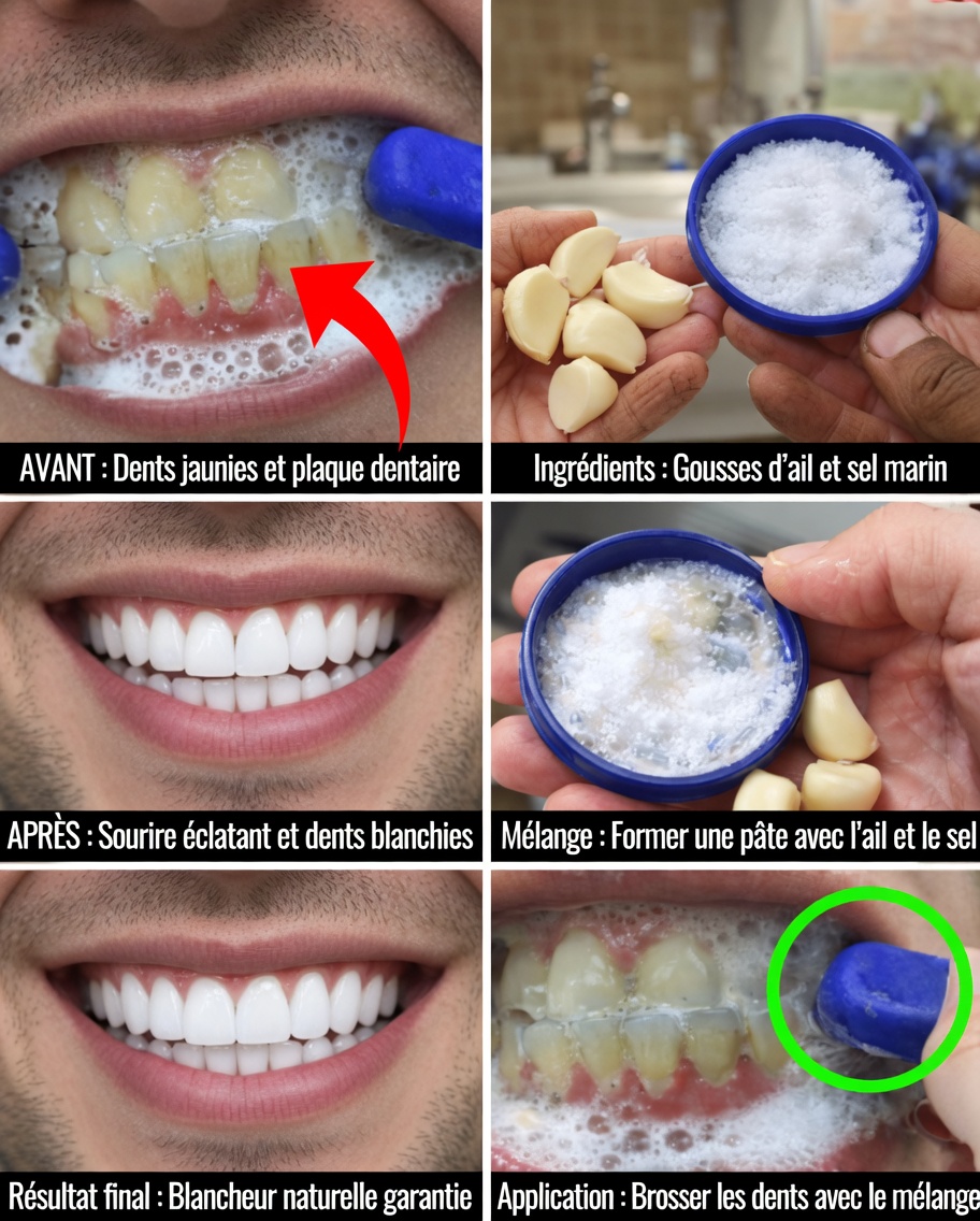 Illuminez rapidement votre sourire : astuces simples pour blanchir les dents à la maison en quelques minutes