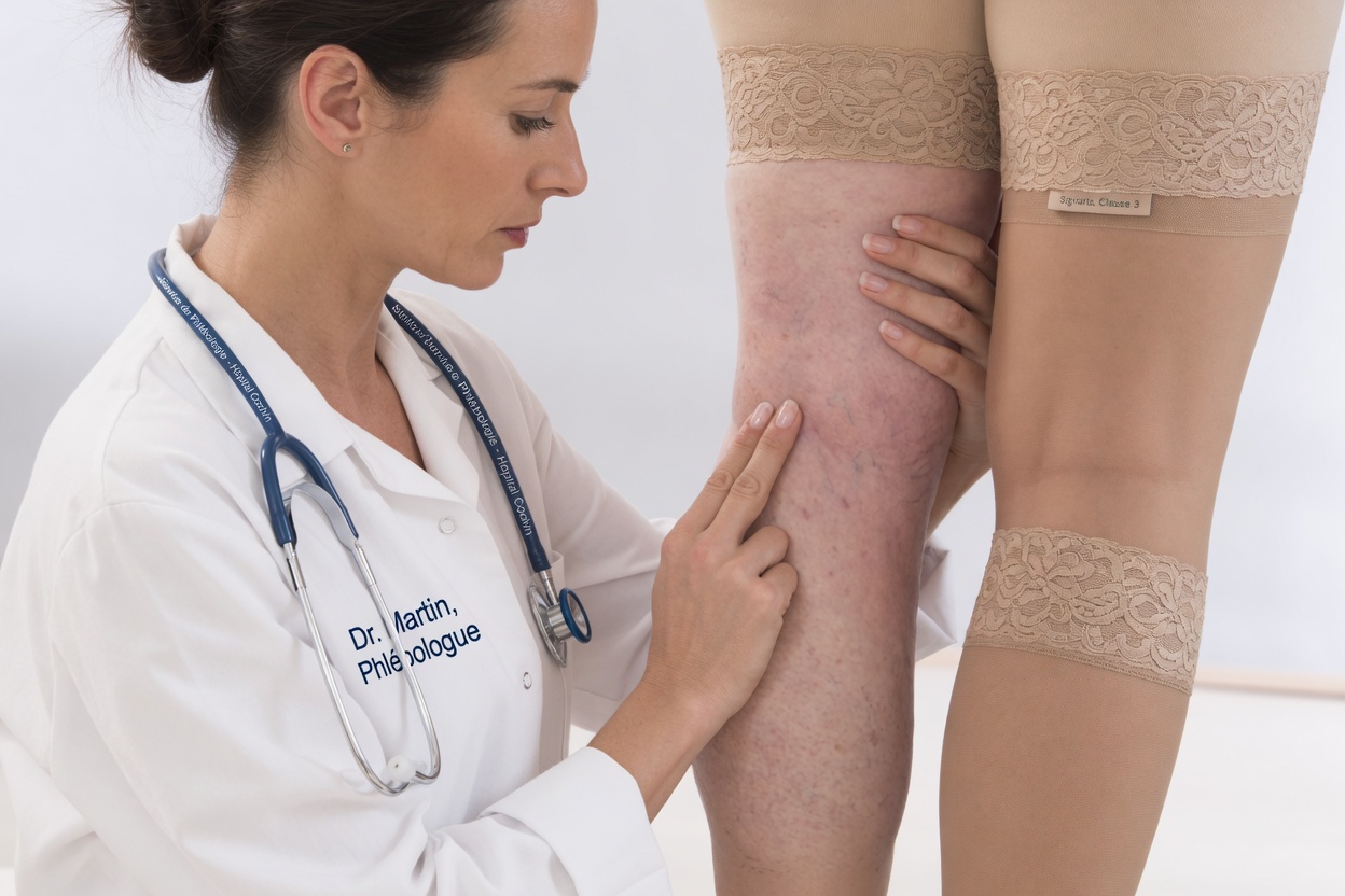 Inquiet au sujet de veines saillantes aux jambes après 50 ans ? Découvrez cette simple habitude en cuisine