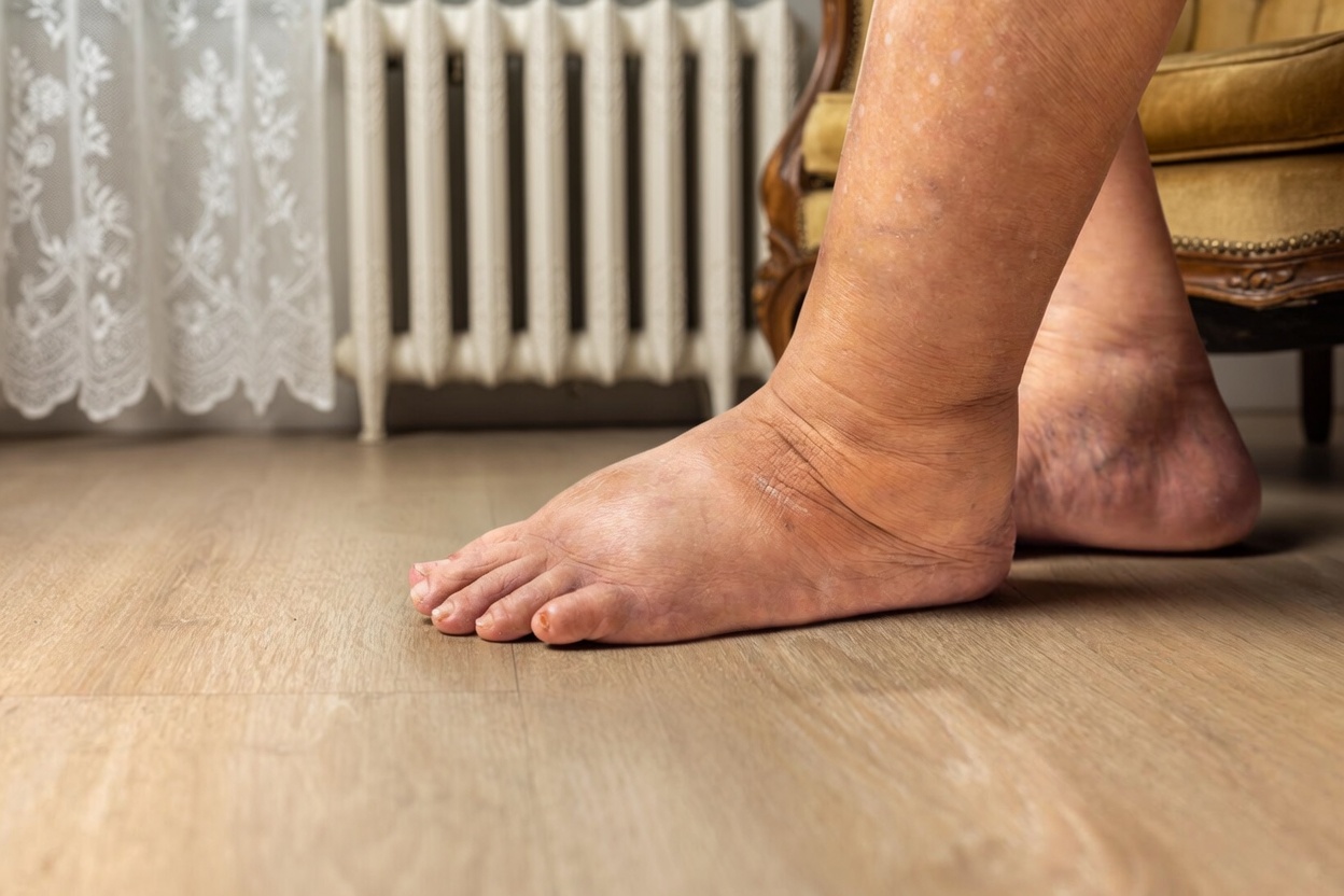 Avertissement sur l’amlodipine pour les seniors : 12 effets secondaires discrets que beaucoup de gens manquent