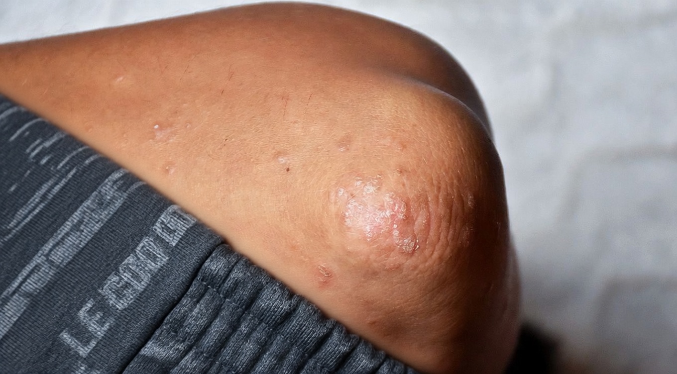 Astuce Vaseline + sel : le vieux truc pour une peau plus ferme et plus lisse, qui redevient discrètement viral