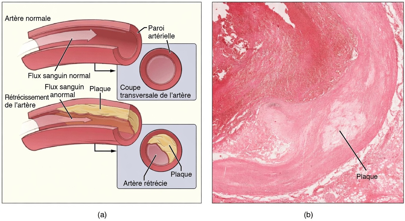 Mélangez ces 3 objets du quotidien avant de vous coucher – regardez vos artères s’assouplir pendant que vous dormez