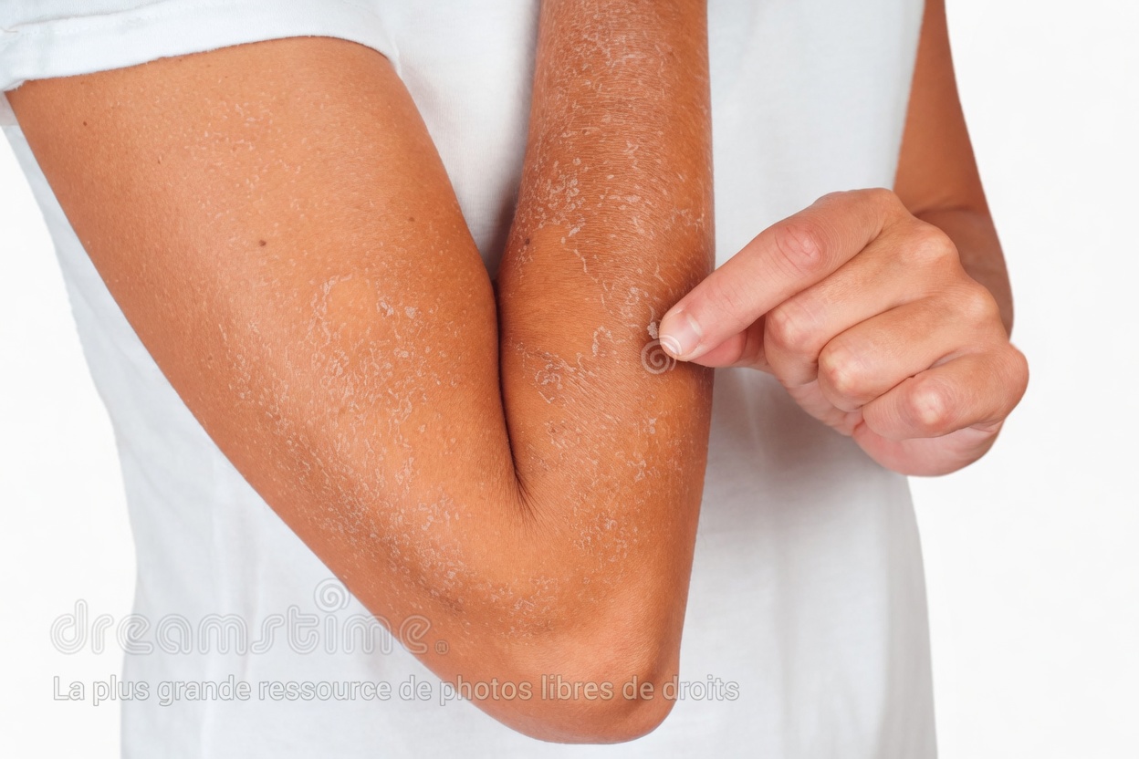 23 Signes d’alerte importants indiquant que vos reins pourraient souffrir en silence et nécessitent une attention